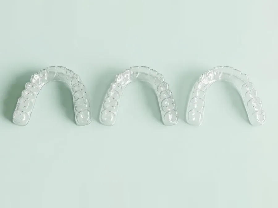 Drei transparente Aligner-Schienen nebeneinander als Serie von Behandlungsschritten